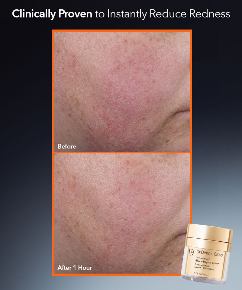 DermInfusions Blur + Repair Moisturizer Cream with Hyaluronic Acid
