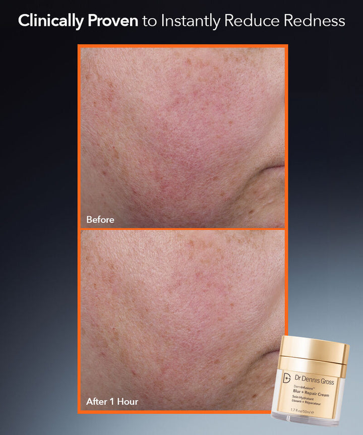 DermInfusions Blur + Repair Moisturizer Cream with Hyaluronic Acid