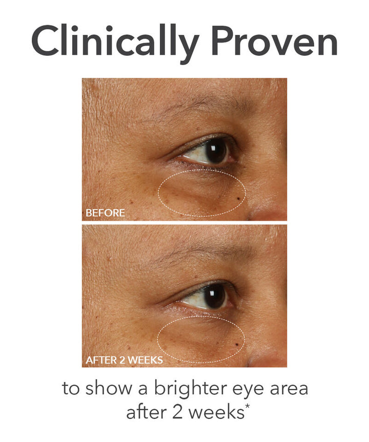 Dr Dennis Gross DermInfusions Fill + Repair Eye Cream with Hyaluronic Acid