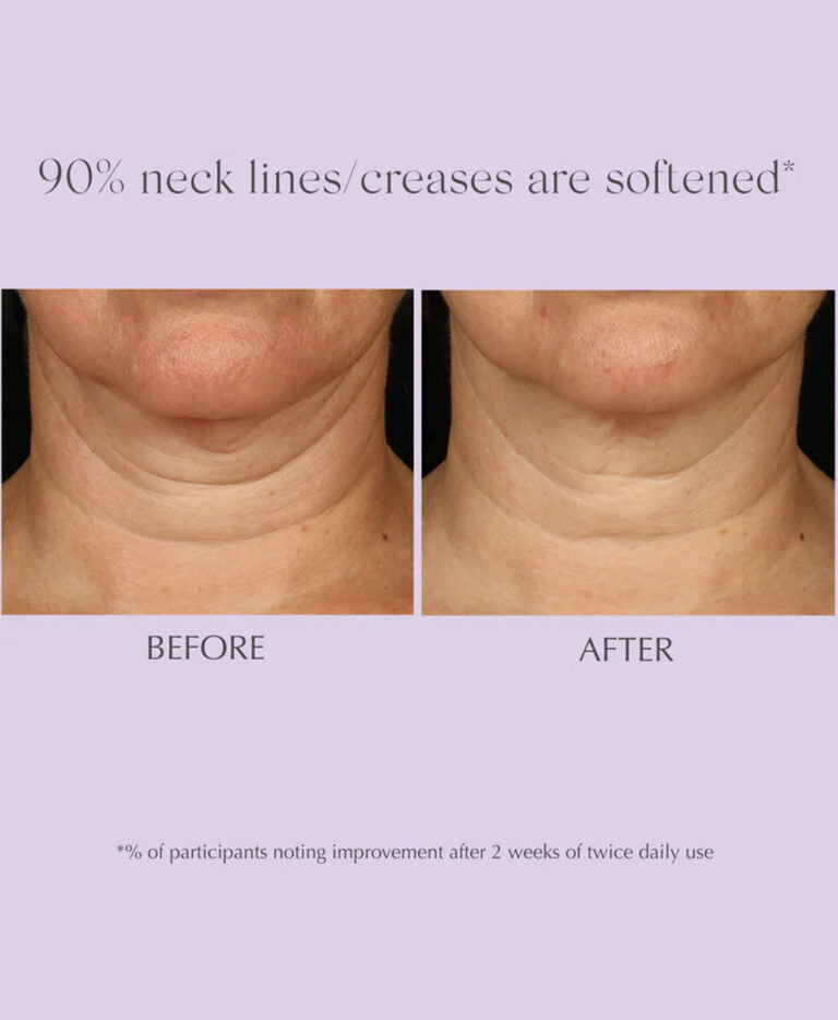 Exuviance Age Reverse Advanced Toning Neck Cream
