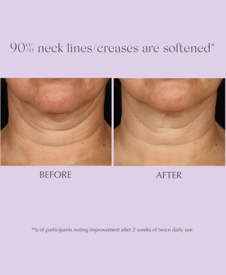 Exuviance Age Reverse Advanced Toning Neck Cream