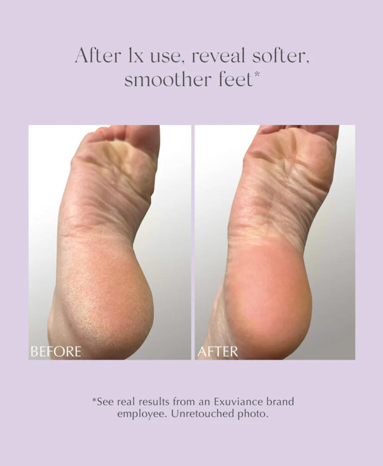 Exuviance Exfoliating & Conditioning Foot Balm