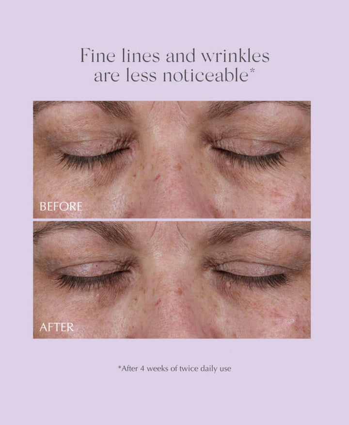 Exuviance Age Reverse Total 360 Eye Contour