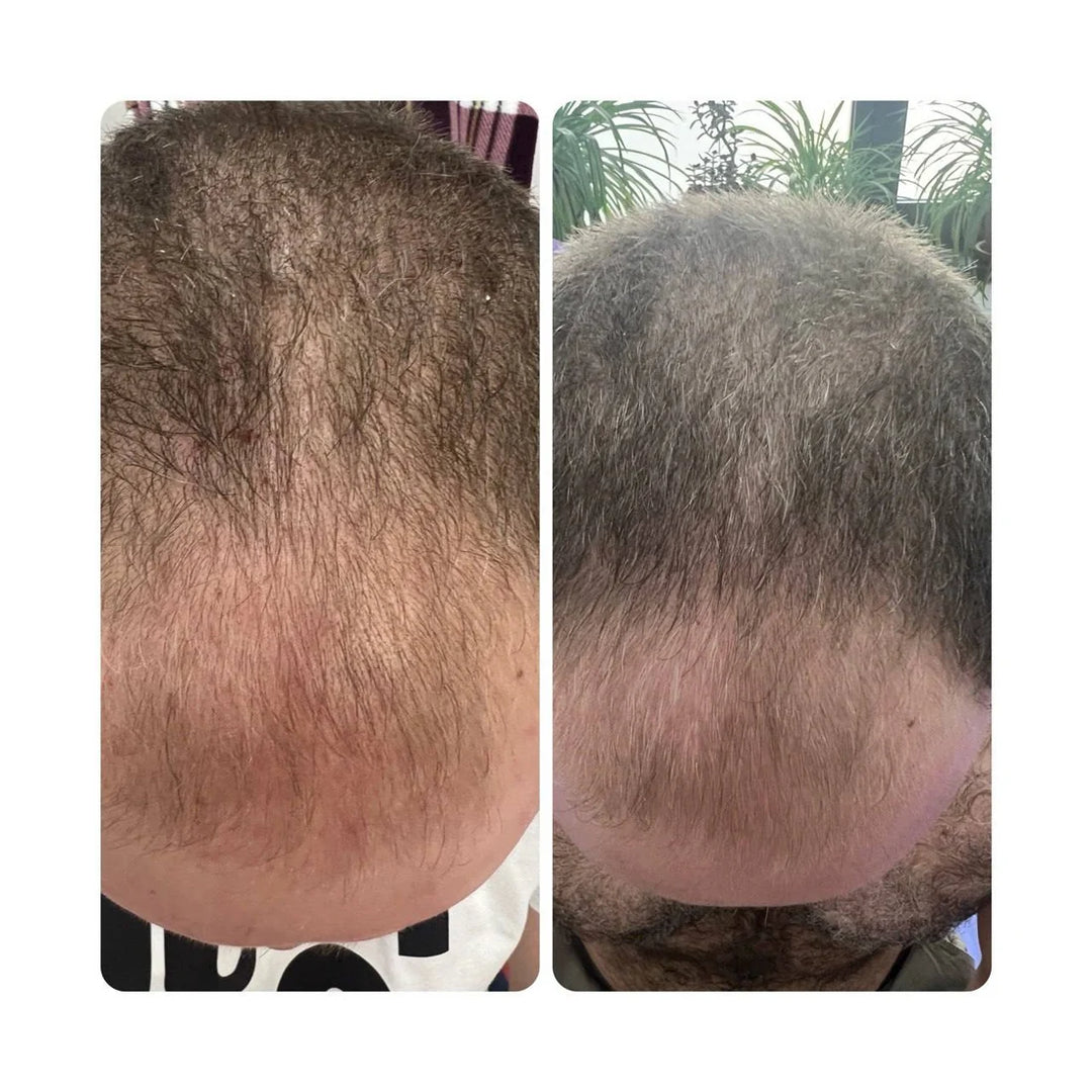 Jeuderm HairGenesis Hair Growth Stimulator 140 ml