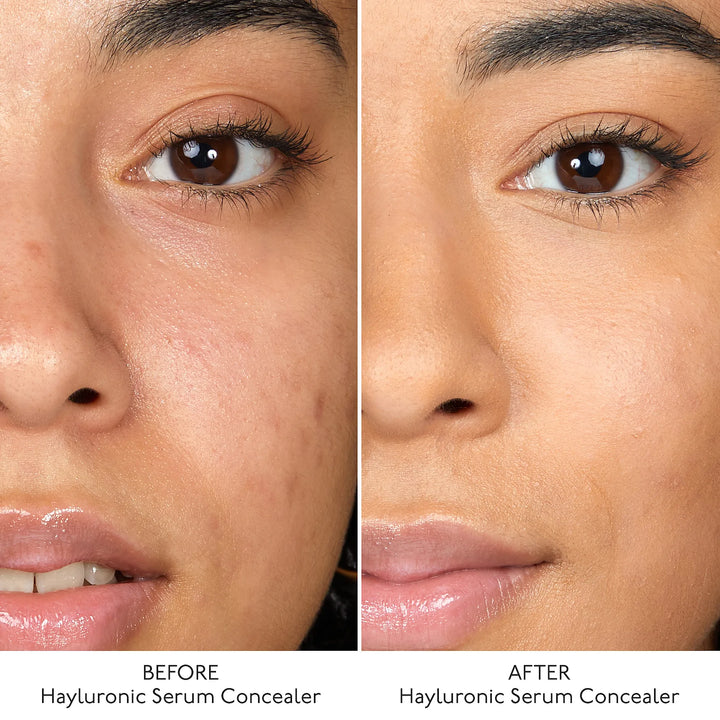 By Terry Hyaluronic Serum Concealer (8HA) 5.CREAM BEIGE