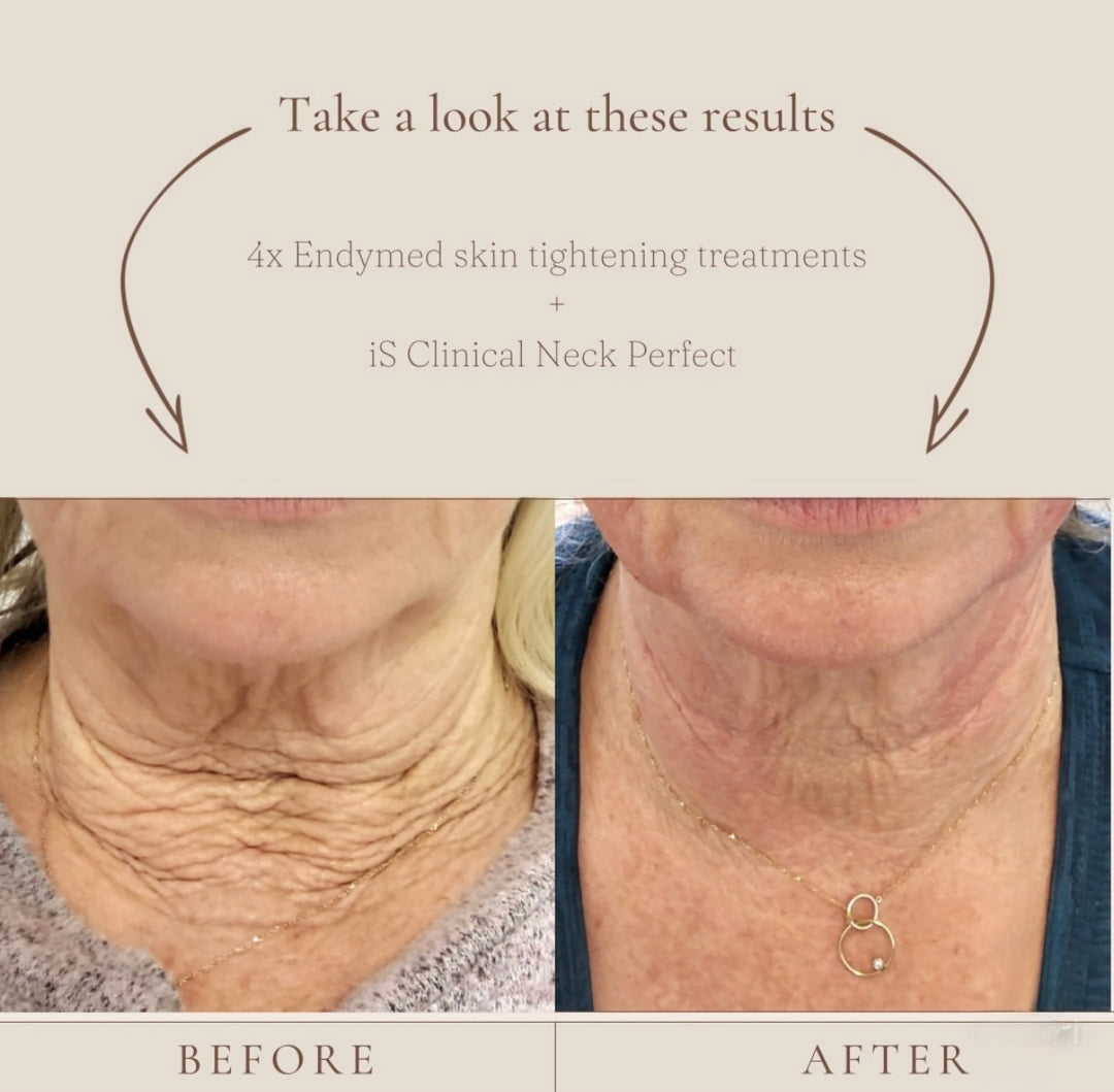 iS Clinical NeckPerfect Complex - FAVORIT!