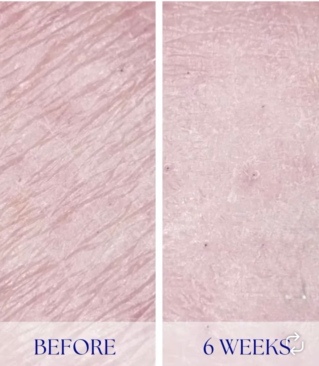 iS Clinical Youth Body Serum