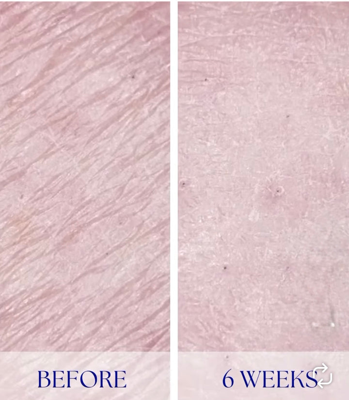 iS Clinical Youth Body Serum