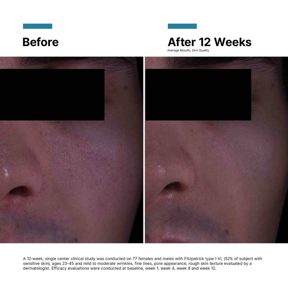 NYHET! SkinCeuticals P-TIOX CREAM+GÅVA VÄRDE 650:-