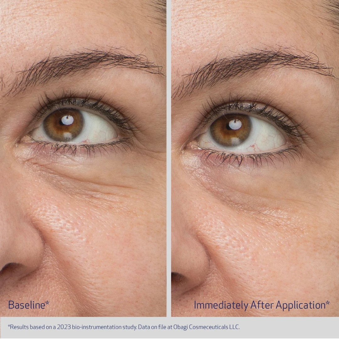 OBAGI Daily Hydro-Dops® Rejuvenating Eye Gel Cream