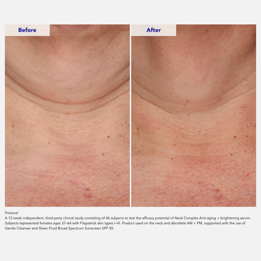 ZO Neck Complex 50 ml NYHET!