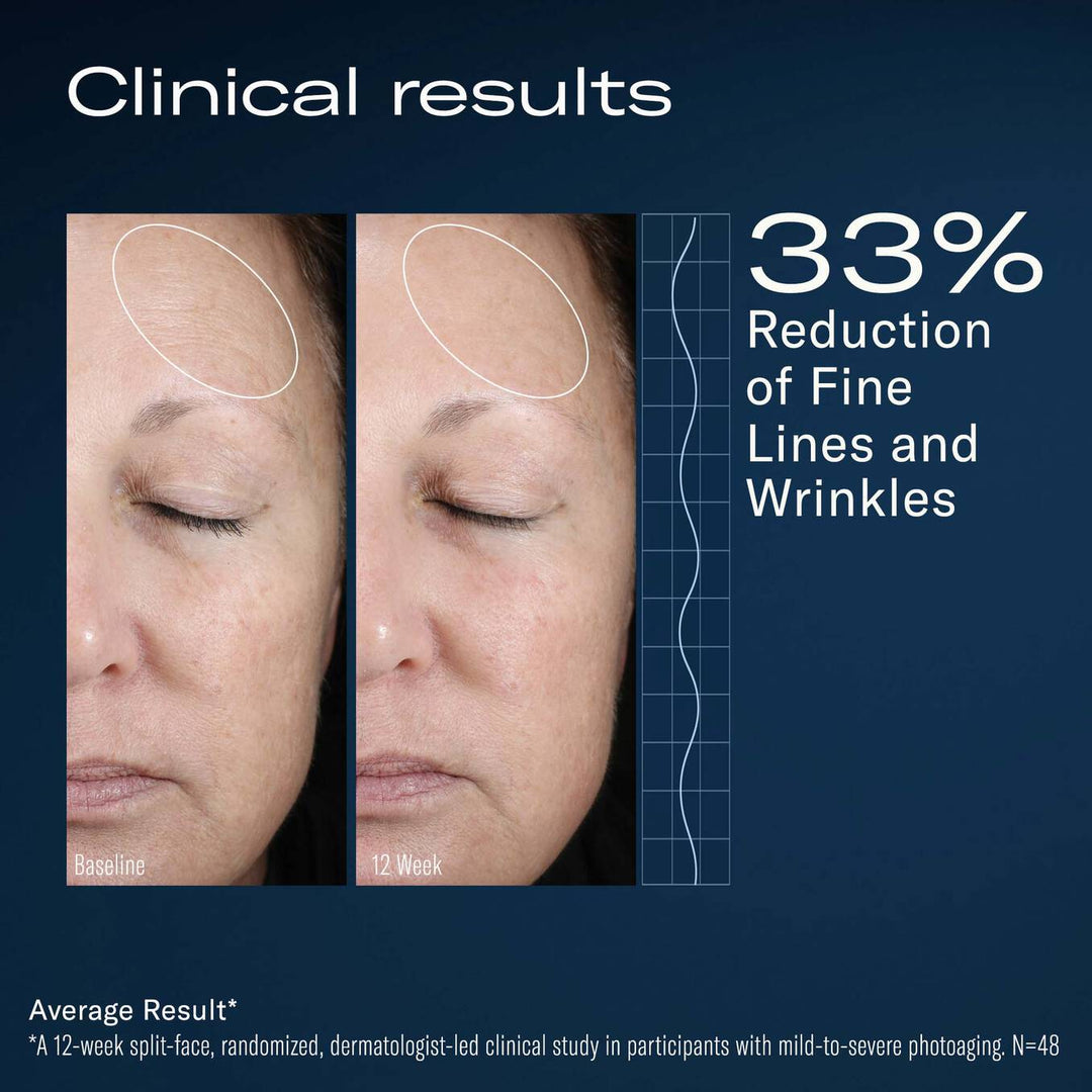 Skinbetter Science AlphaRet Overnight Cream FACE