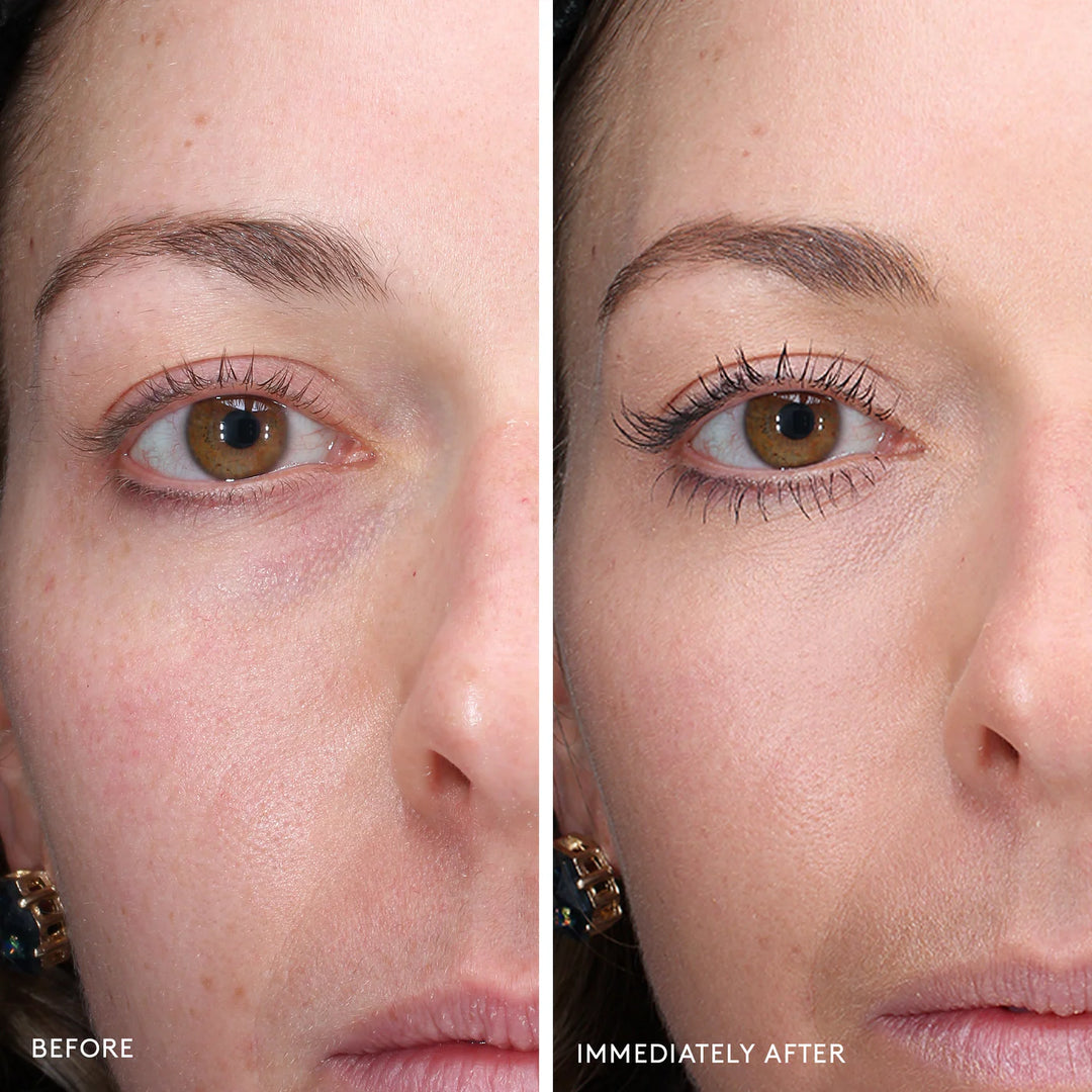 Total Eye® 3-In-1 Renewal Therapy SPF 30