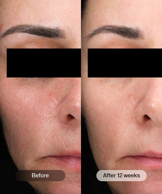 Revision D·E·J Daily Boosting Serum®