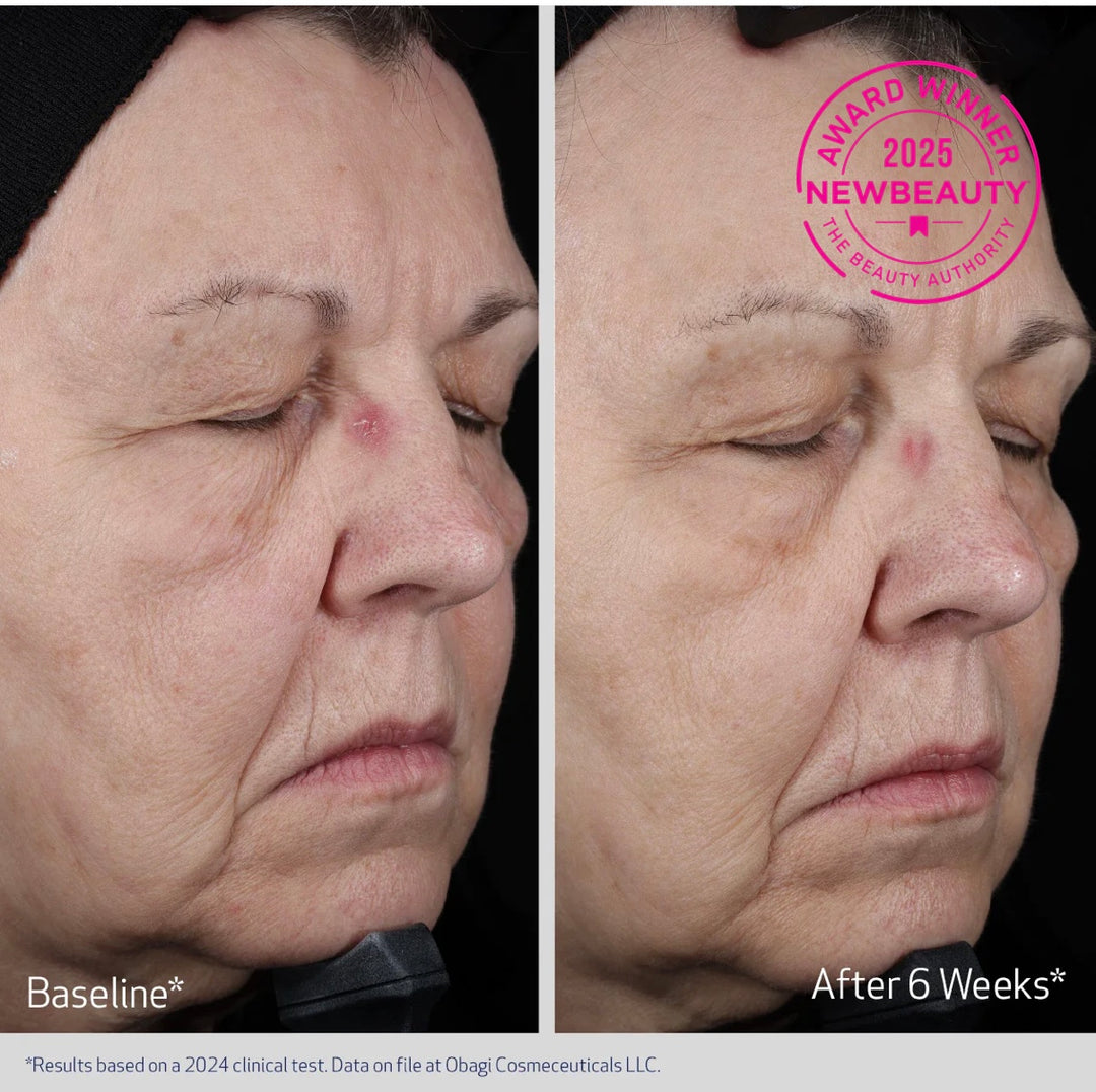 OBAGI Elastiderm Lift up & Sculpt moisturizer - Få Gentle Cleanser (värde 709 kr)