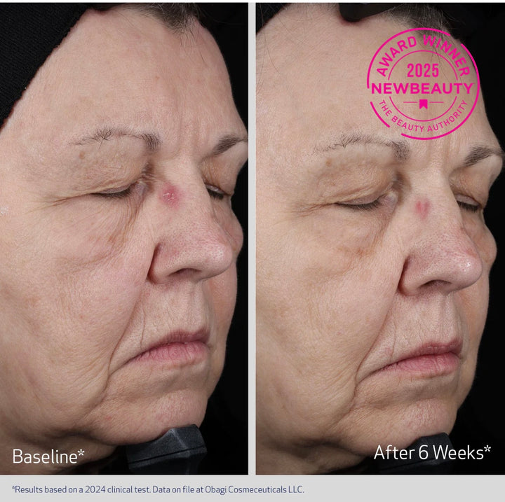 OBAGI Elastiderm Lift up & Sculpt moisturizer - Få Gentle Cleanser (värde 709 kr)