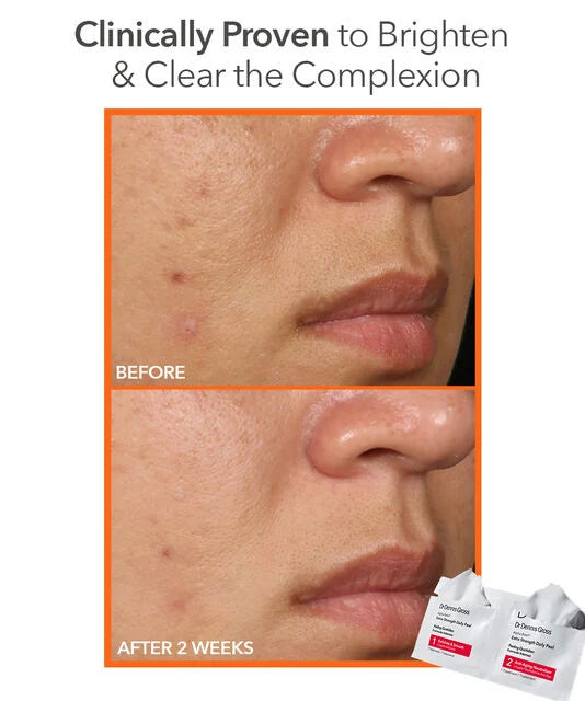 Dr Dennis Gross Alpha Beta® Extra Strength Daily Peel