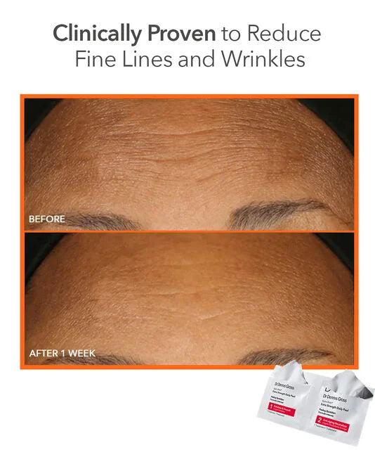 Dr Dennis Gross Alpha Beta® Extra Strength Daily Peel