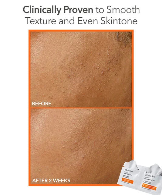 Dr Dennis Gross Alpha Beta® Universal Daily Peel