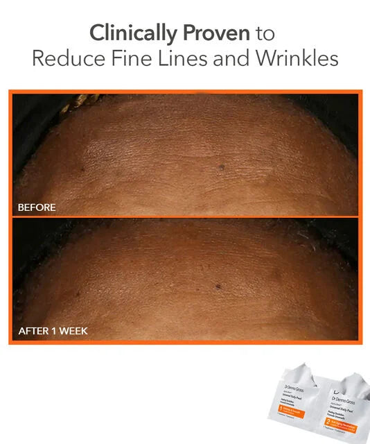 Dr Dennis Gross Alpha Beta® Universal Daily Peel