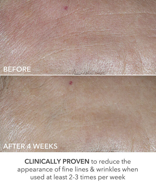Dr Dennis Gross Advanced Retinol + Ferulic Perfectly Dosed Treatments (Universal 0.2%)