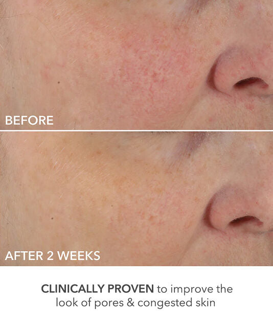 Dr Dennis Gross Advanced Retinol + Ferulic Perfectly Dosed Treatments (Universal 0.2%)