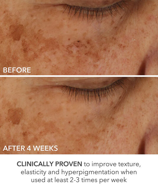 Dr Dennis Gross Advanced Retinol + Ferulic Perfectly Dosed Treatments (Universal 0.2%)
