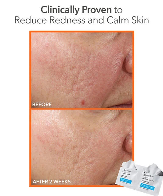 Dr Dennis Gross Alpha Beta® Ultra Gentle Daily Peel (30 st)