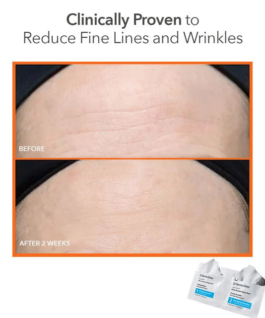 Dr Dennis Gross Alpha Beta® Ultra Gentle Daily Peel (30 st)