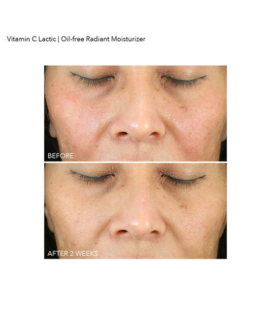 Dr Dennis Gross Vitamin C Lactic Oil-Free Radiant Moisturizer