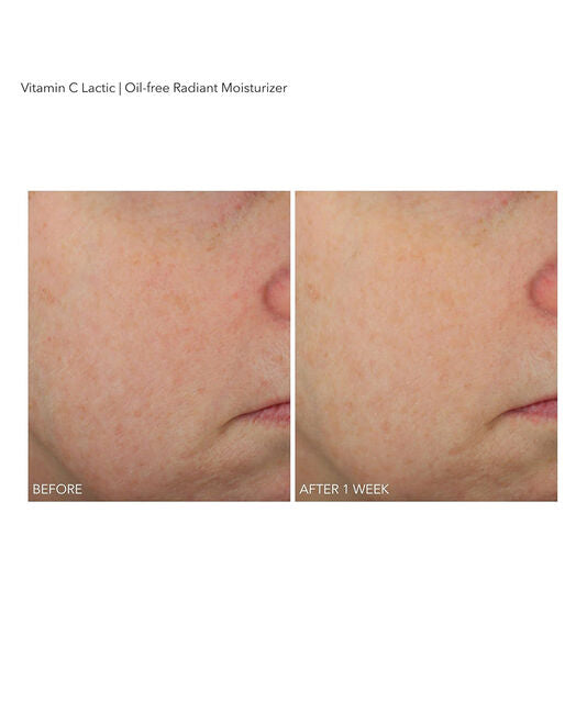 Dr Dennis Gross Vitamin C Lactic Oil-Free Radiant Moisturizer