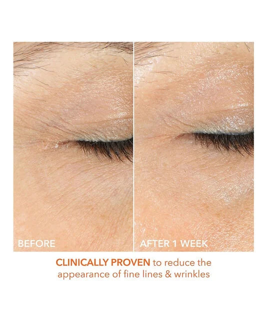 Dr Dennis Gross Dr Dennis Gross Vitamin C + Lactic Firm & Bright Eye Treatment