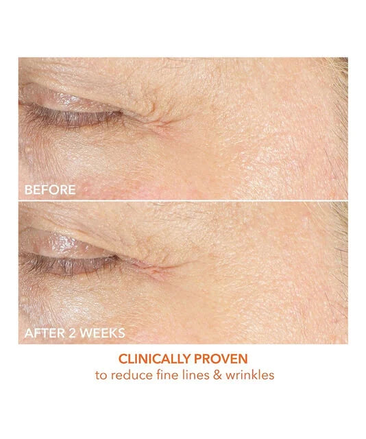 Dr Dennis Gross Dr Dennis Gross Vitamin C + Lactic Firm & Bright Eye Treatment