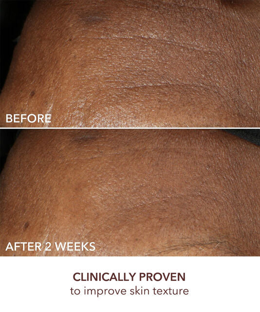 Dr Dennis Gross Advanced Retinol + Ferulic Intense Wrinkle Cream