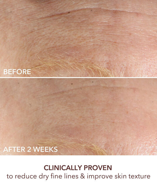 Dr Dennis Gross Advanced Retinol + Ferulic Intense Wrinkle Cream