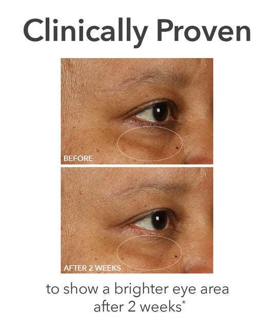 De Dennis Gross DermInfusions™ Fill + Repair Eye Cream with Hyaluronic Acid