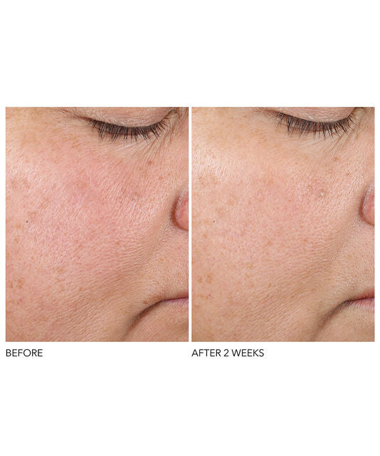 De Dennis Gross Advanced Retinol + Ferulic Texture Renewal Serum