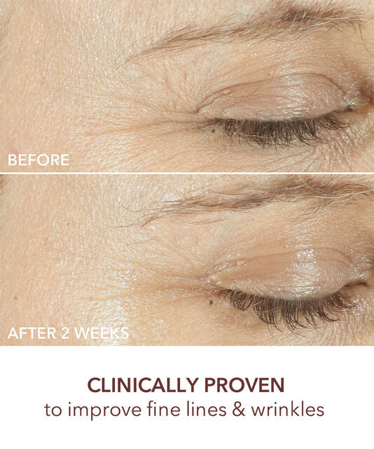 Dr Dennis Gross  Advanced Retinol + Ferulic Triple Correction Eye Serum