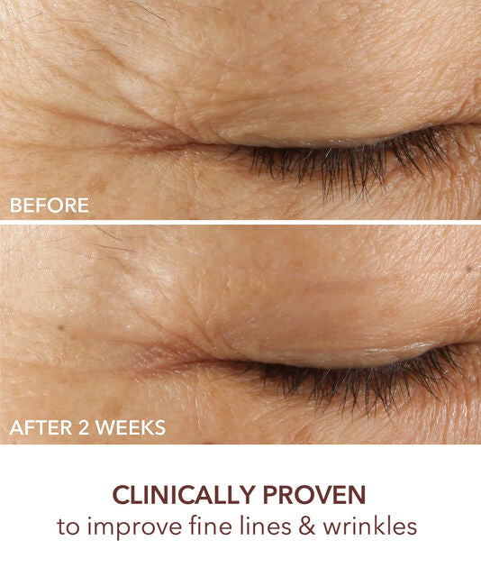 Dr Dennis Gross  Advanced Retinol + Ferulic Triple Correction Eye Serum