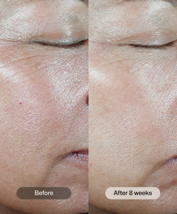Revision Skincare C+ Correcting Complex 30%