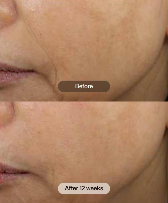 Revision Skincare D·E·J Face Cream®