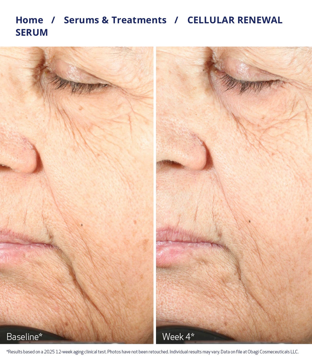 OBAGI Nu-Gen Cellular Renewal Serum