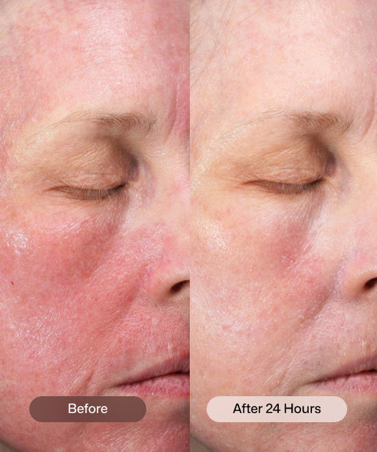 Revision Skincare CMT PostProcedure Cream