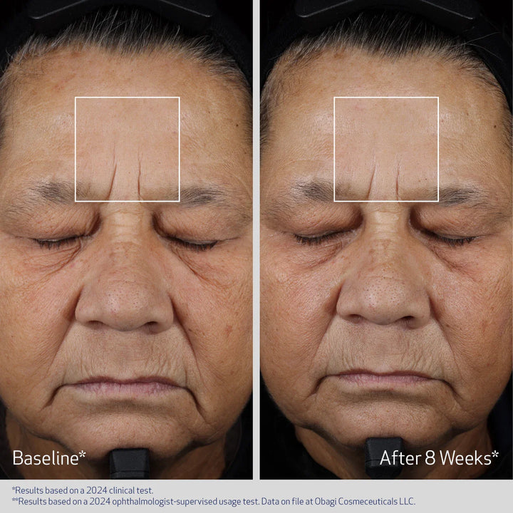 OBAGI Elastiderm Advanced Filler Concentrate