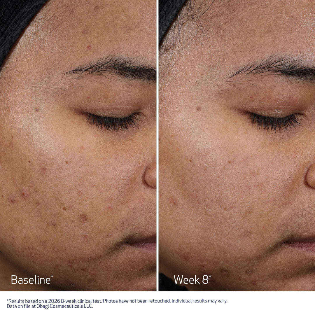 OBAGI CLENZIDERM M.D. Resurface Multi Acid Peel Pads