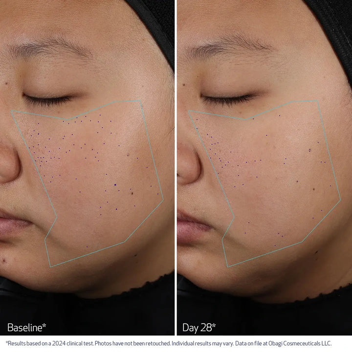 OBAGI CLENZIDERM M.D. Pore Therapy Exfoliating BHA Toner