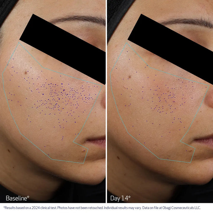 OBAGI CLENZIDERM M.D. Pore Therapy Exfoliating BHA Toner