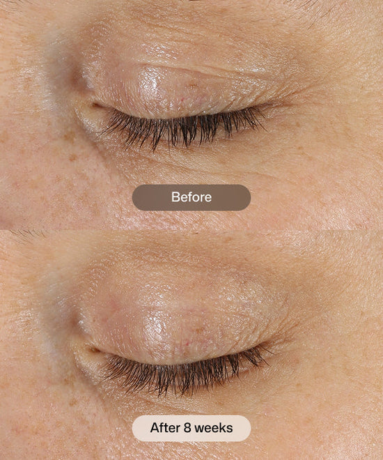 Revision Skincare D.E.J Eye Cream