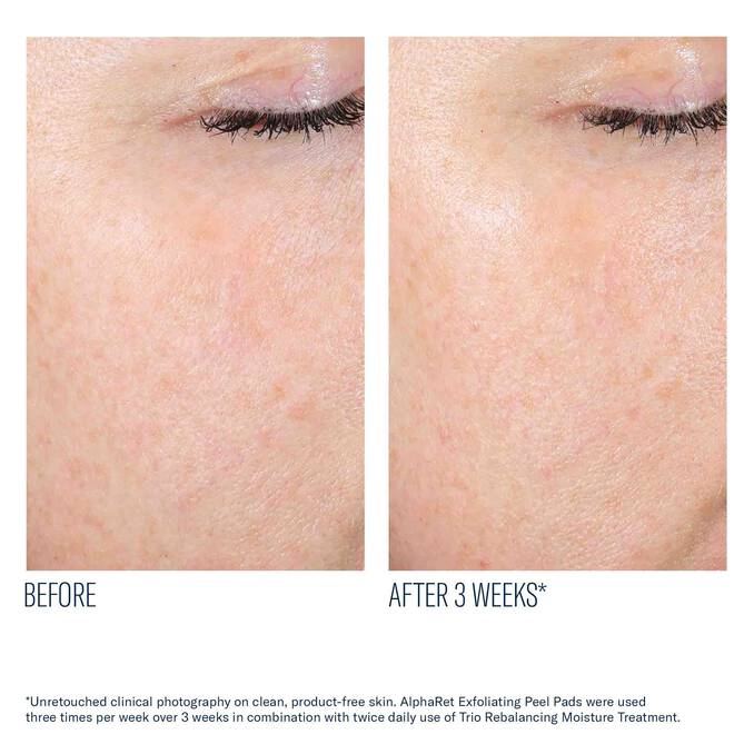 Skinbetter Science AlphaRet Exfoliating Peel Pads