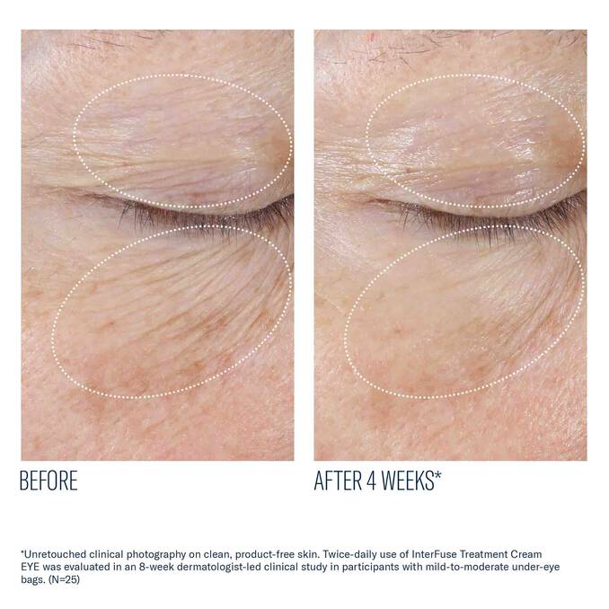 Skinbetter Science InterFuse Treatment Cream EYE